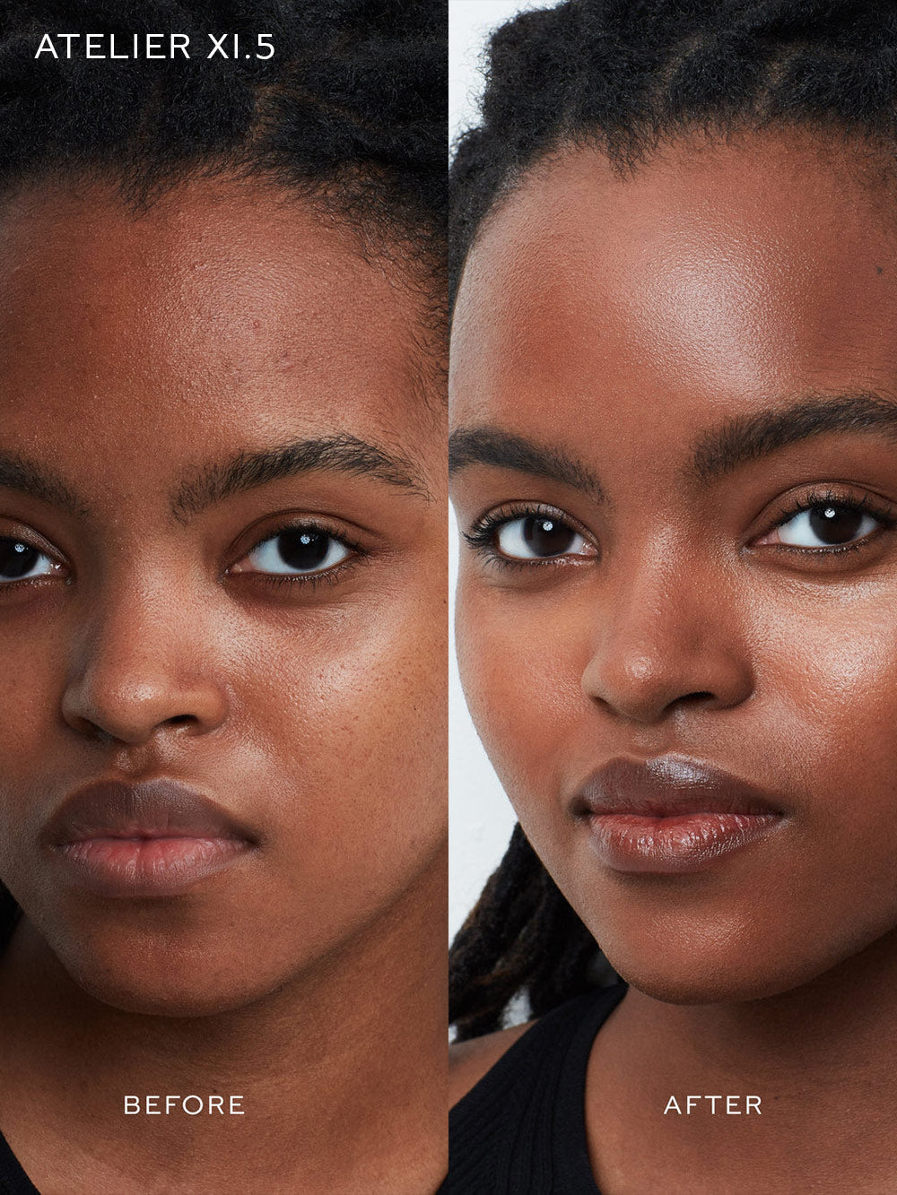 Vital Skincare Complexion Drops