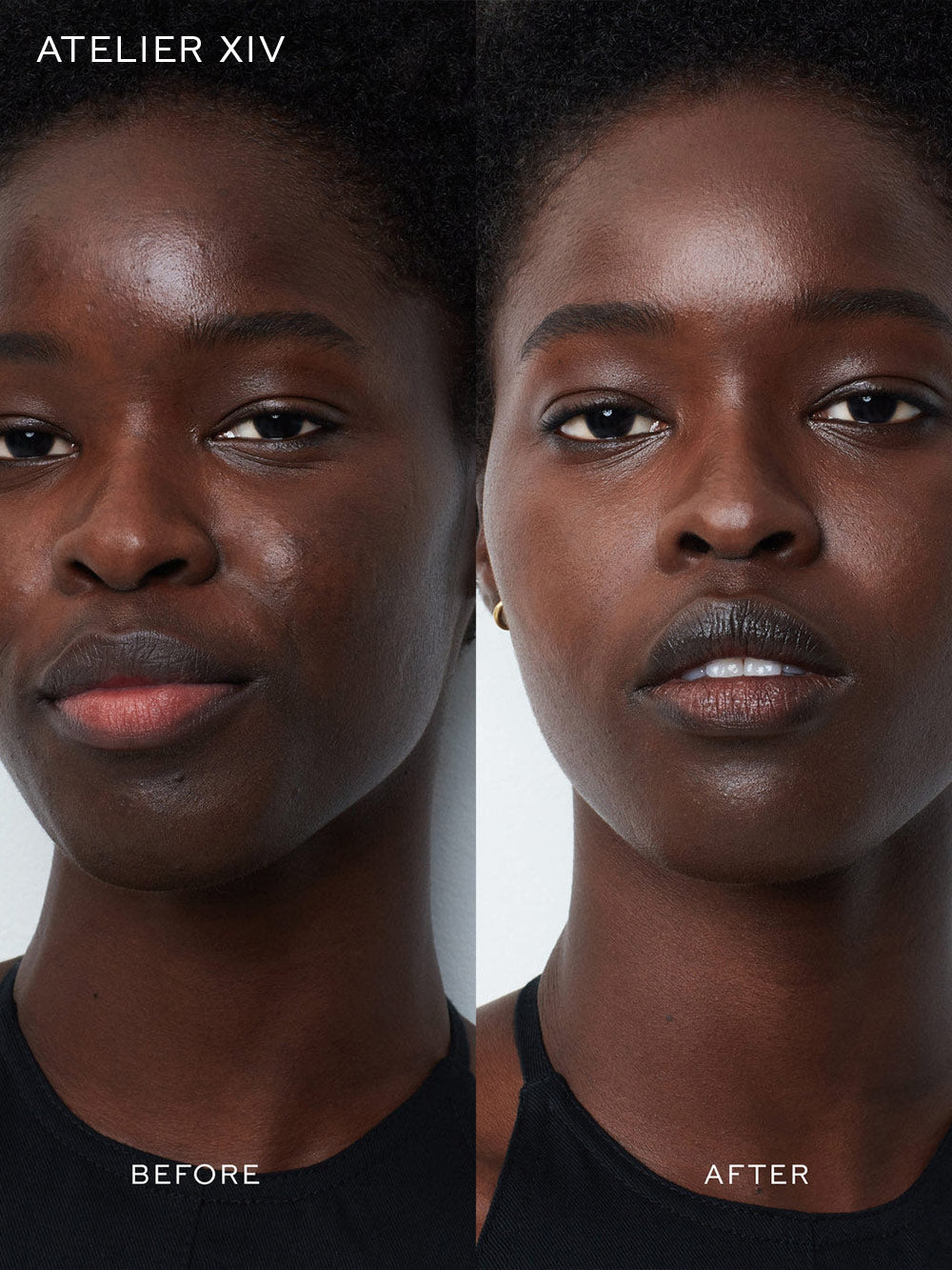 Vital Skincare Complexion Drops