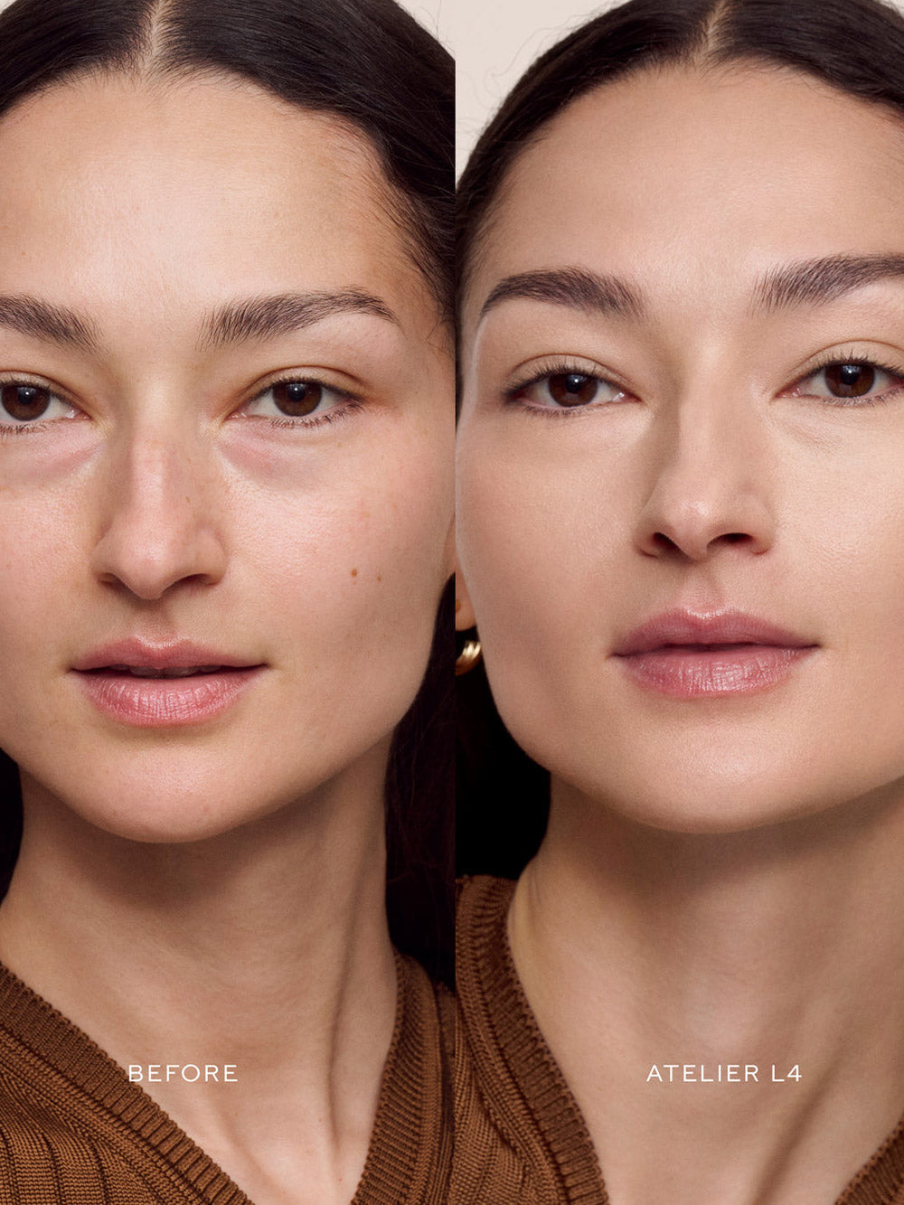 Vital Skincare Concealer