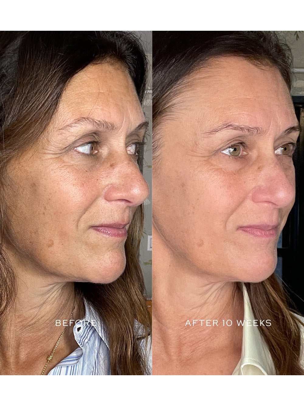Suprême C Serum
