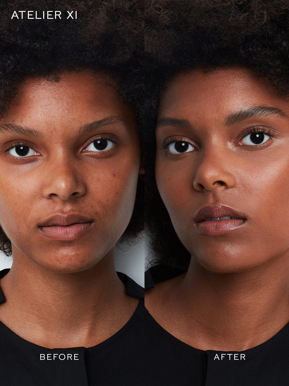 Vital Skincare Complexion Drops